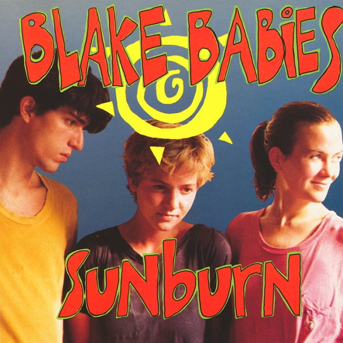 Sunburn