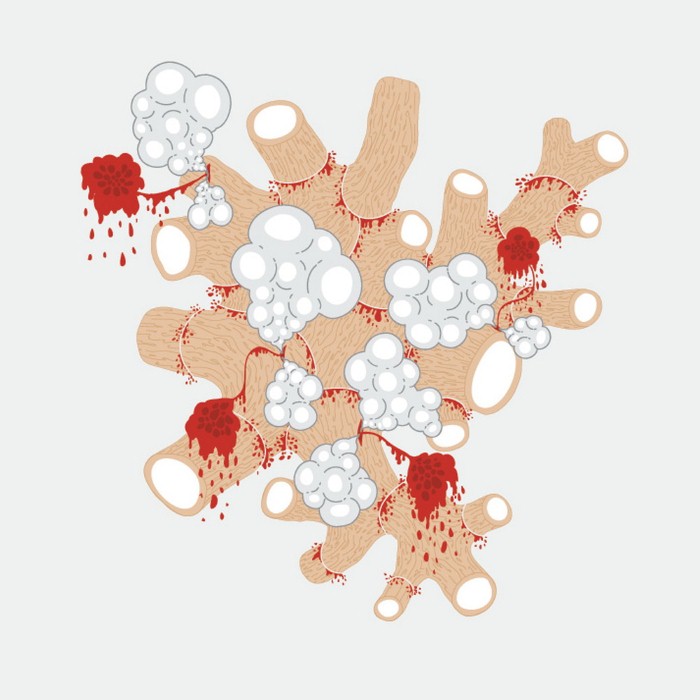The Exquisite Death of Saxon Shore