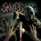 Trample the Weak, Hurdle the Dead by Skinless